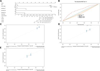 Angiogenic Factor-Based Signature Predicts Prognosis and Immunotherapy Response in Non-Small-Cell Lung Cancer